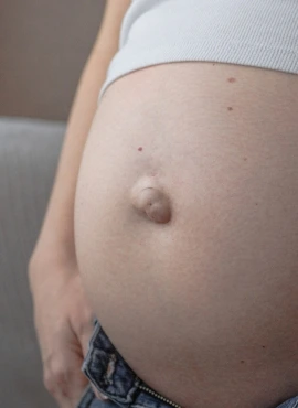 62 Cirujano para Hernia Umbilical en Guadalajara