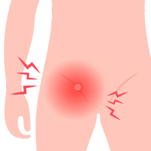 Cirujano Especialista en Hernias en Guadalajara