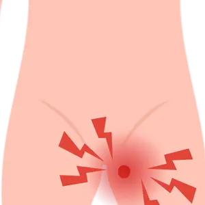 Hernia testicular