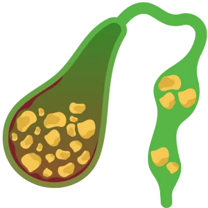 vesicula Cirujano Gastroenterólogo en Guadalajara